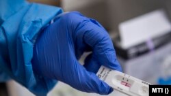 Positive sample in the hands of an employee of the National Ambulance Service (OMSZ) at the OMSZ Pók street filter bus in Óbuda