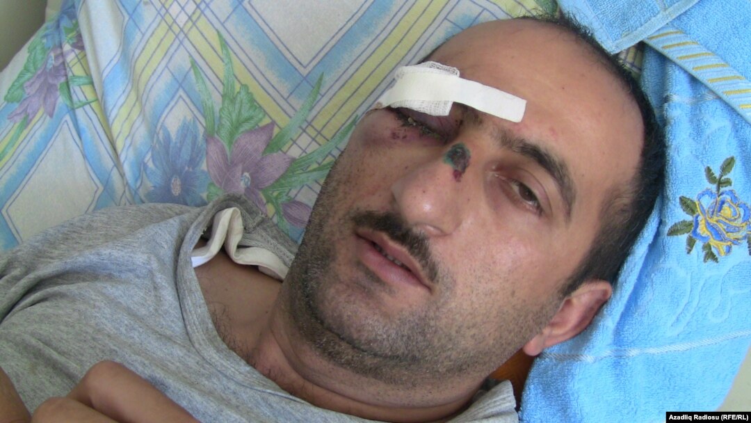 İdrak Abbasov