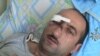 Azerbaijani journalist Idrak Abbasov recovers from his beating in a Baku hospital. 