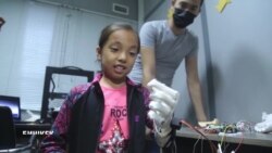 Уникальный биопротез руки: совместная работа программистов и врачей из Кыргызстана