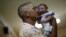 Brazil has also recorded a dramatic spike in cases of microcephaly, which can cause severe developmental issues and sometimes death. Nearly 3,900 cases have been reported in the country of 200 million since October, compared with the previous annual average of just 160 cases. 