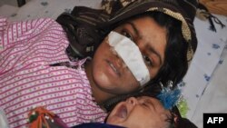 Reza Gul, 20, lies on a bed with her baby as she receives treatment at a hospital in the northern province of Faryab after her husband cut off her nose.