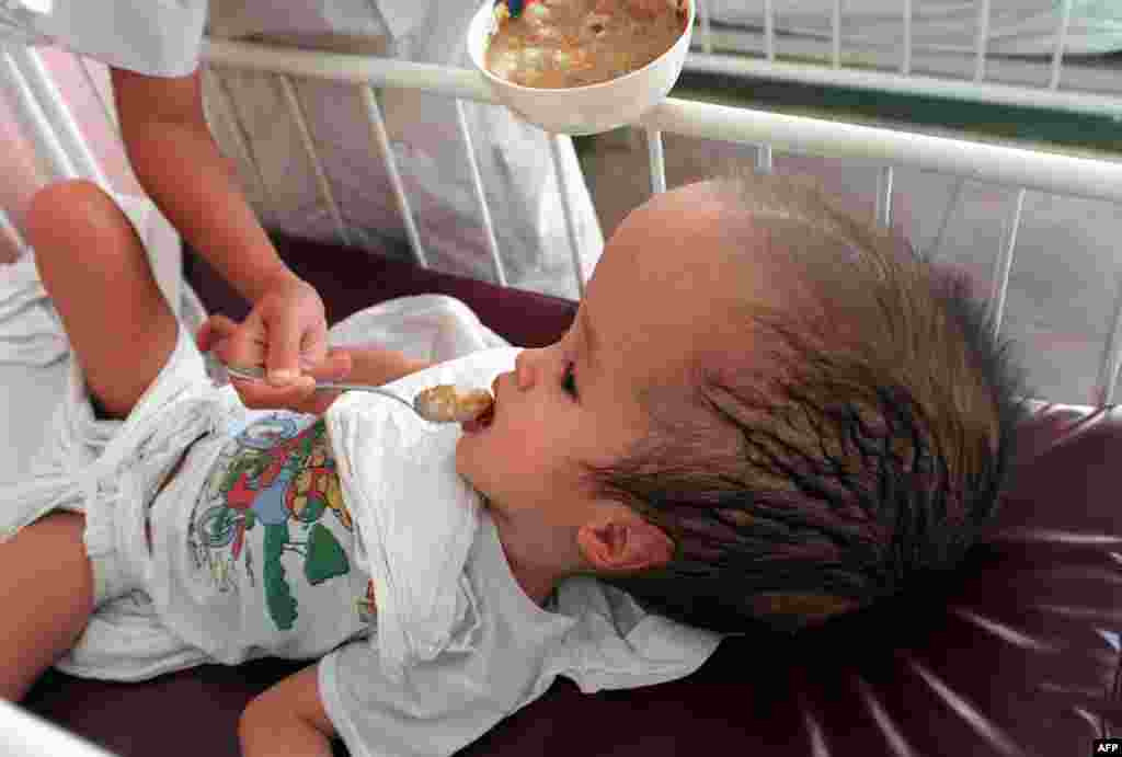 A 2-year-old girl with an enlarged head who was born to a couple exposed to Agent Orange is cared for at the Agent Orange Victims Service in a hospital in Ho Chi Minh City in 1998.