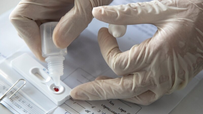 Pesë gjëra që duhet t’i dini për testet e koronavirusit