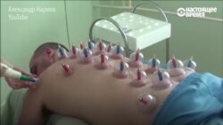 Поставьте банки, чтобы победить на Олимпиаде