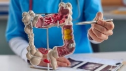 Cancerul colorectal este o boală malignă care apare atunci când celulele din intestinul gros sau din rect încep să se înmulțească necontrolat.