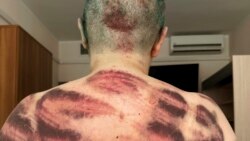 Цитаты Свободы. Лаборатория беспредела