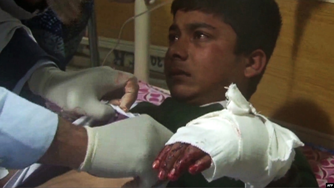 An injured student receives treatment at a Peshawar hospital following the attack.