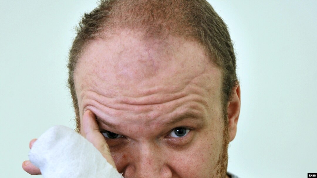Kashin says he could have been beaten for his reporting on the Khimki forest or Pskov Oblast issues. 