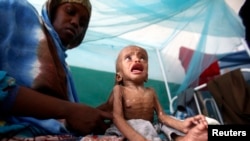Izgladnjela djeca su izložena devet puta većem riziku da umru od kolere ili boginja. Foto. Somalija