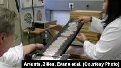 Alymlar adamyň beýnisine degişli ylmy barlaglary geçirýärler, Kanada 