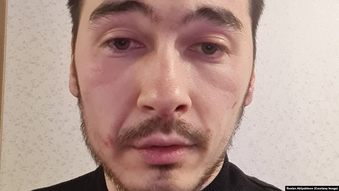 Руслан Аблякимов