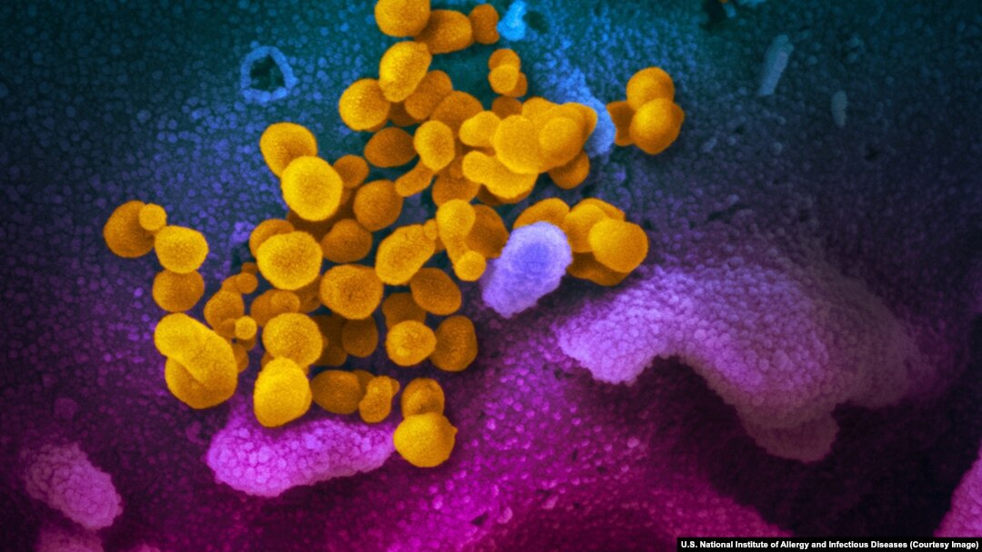 SARS-COV-2 (în galben) pe un țesut uman, imagine la microscop
