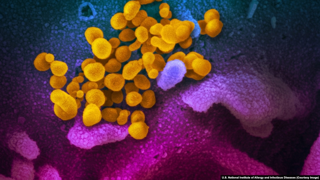 Coronavirus (galben) pe suprafața unor celule (în roz și mov), crescute în laborator de cercetători americani