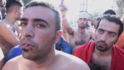 Migranti na granici zašivaju usta iz protesta