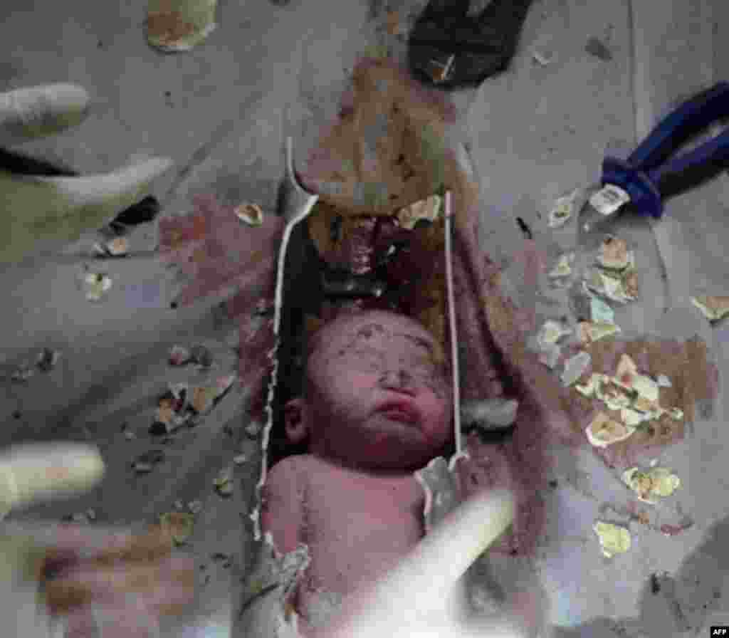 This screen shot shows Chinese rescue workers breaking away bits of a pipe to remove a newborn baby boy stuck for two to three hours inside a sewage pipe in an apartment building in the city of Jinhua in the eastern province of Zhejiang. The baby is healthy. The mother, who says she gave birth unexpectedly, is in serious condition due to complications. (AFP)