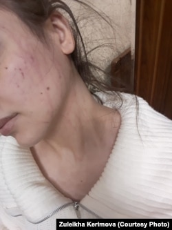 ზულეიხას თქმით, ეს ფოტო მისმა დამ, გარდაცვალებამდე რამდენიმე ხნით ადრე გამოუგზავნა და უთხრა, რომ დაზიანებები ბიძაშვილმა მიაყენა
