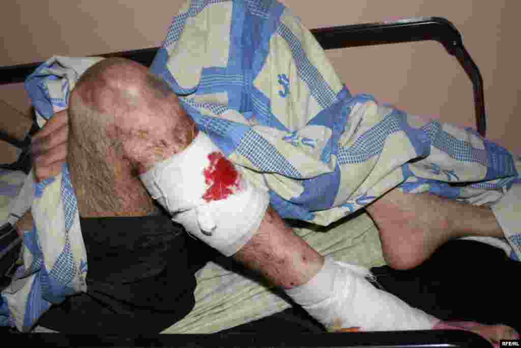 ბექაურის თქმით, პოლიციამ სასტიკად სცემა მშვიდობიანი აქციის მონაწილეები.