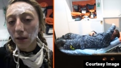 ჯანდაცვის უწყების ცნობით, კლინიკაში გადაყვანა დასჭირდა აქციის 6 მონაწილესა და 21 სამართალდამცველს. 30-მდე პირს ადგილზე გაუწიეს სამედიცინო დახმარება.