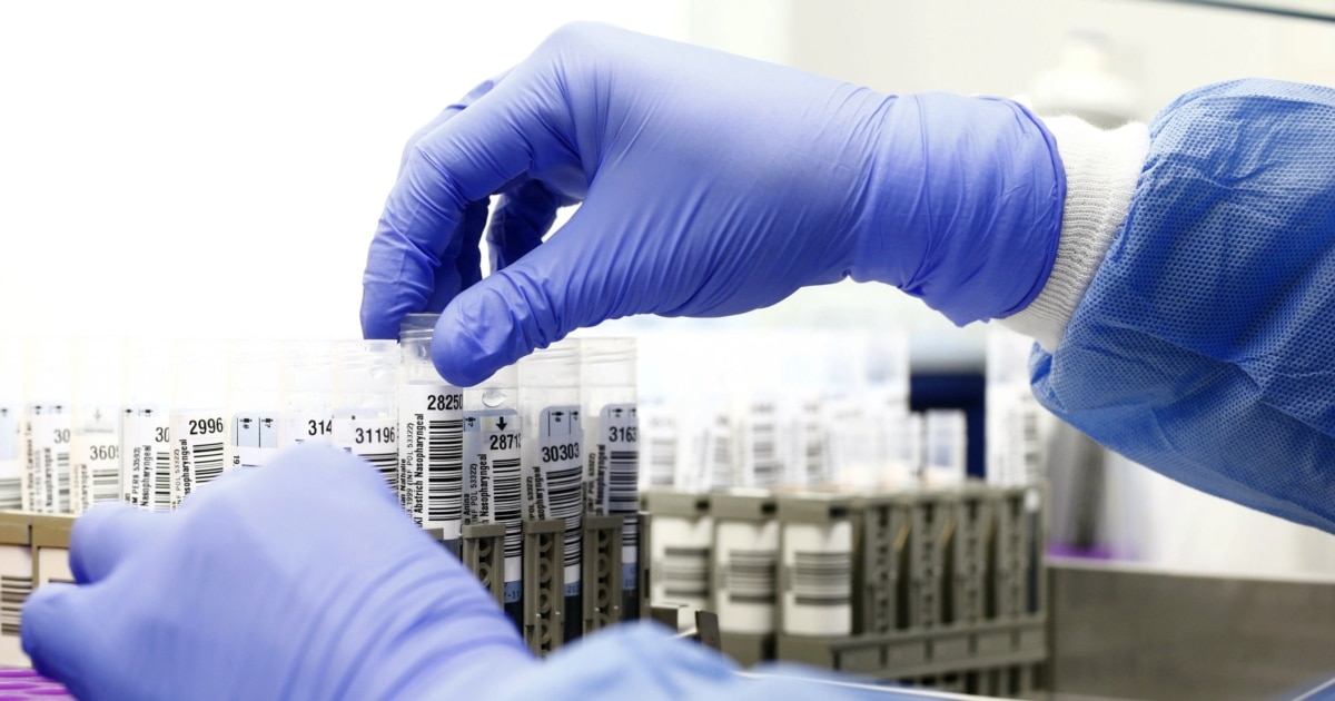 SHBA ja publikon të dhëna për laboratorë biologjikë në mbi 30 vende  përfshirë Ukrainën