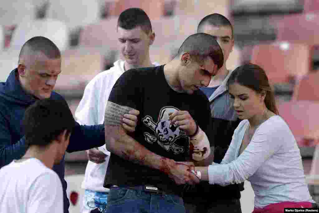 An injured Red Star fan is helped by friends during clashes with riot police ahead of a match against Partizan in April 2015.The two teams’ supporters have frequently clashed in recent decades and in 1999 the rivalry was forever stained when Partizan fans fired a rocket into the Red Star section of the stadium, killing teenager Aleksandar Radovic.
