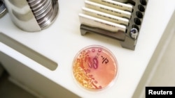 Лабораторна проба от клебсиела пнеумония.