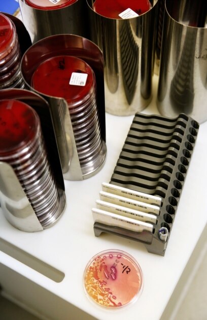 Редовна дезинфекция хигиена и контрол Това би било достатъчно за